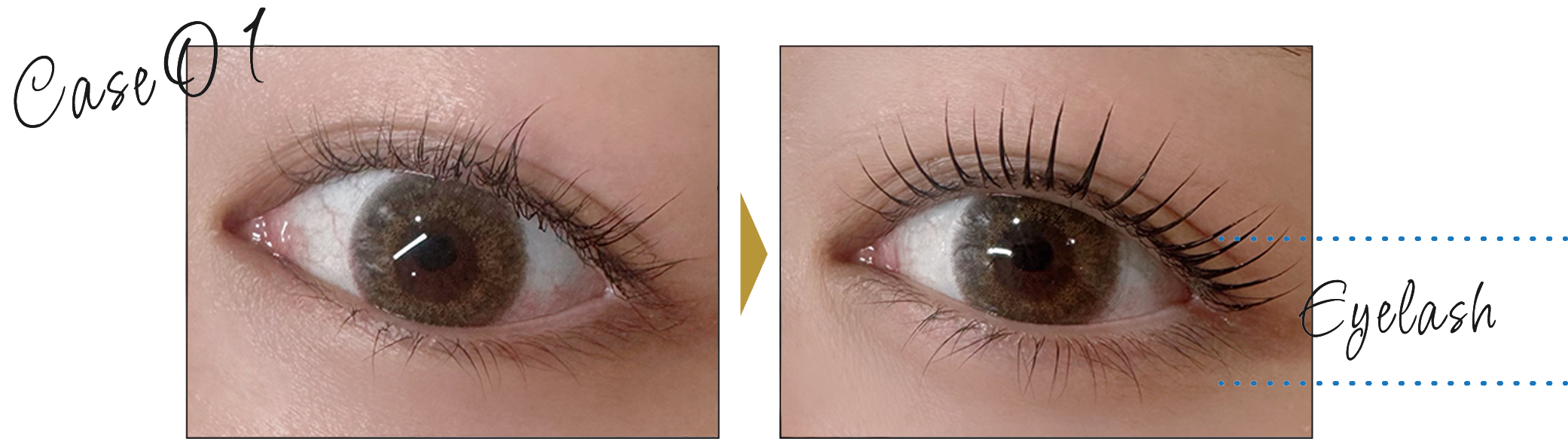 beforeafter
