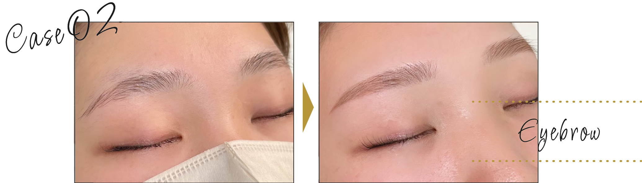 beforeafter