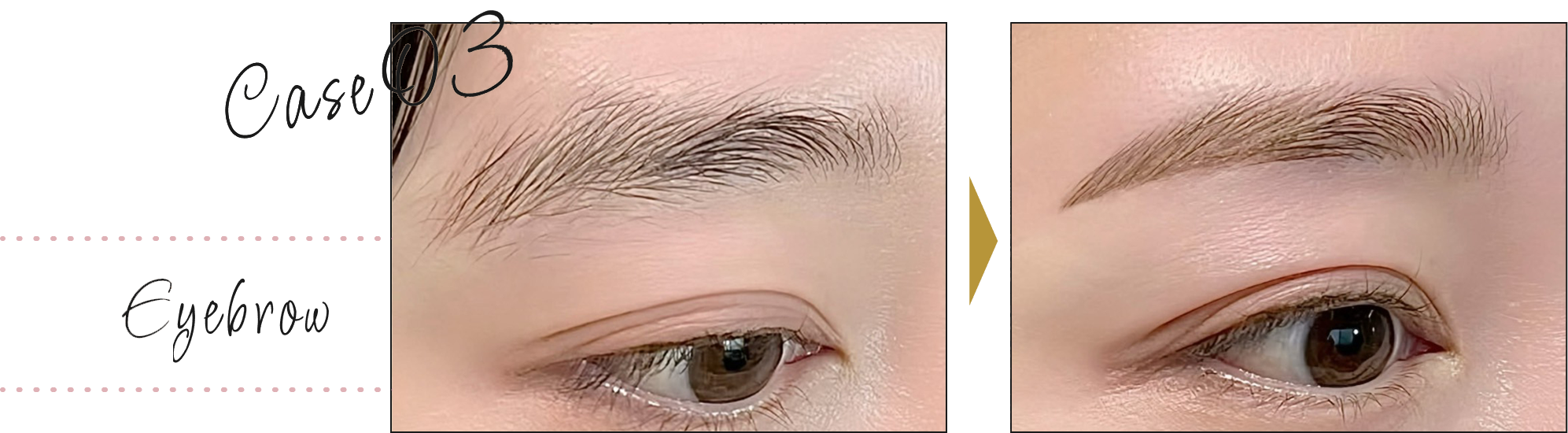 beforeafter